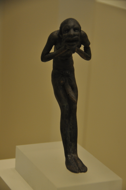 Apotropaic statue of a man suffering from tuberculosis