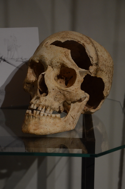Geispolsheim, Human skull damaged by stabwounds 